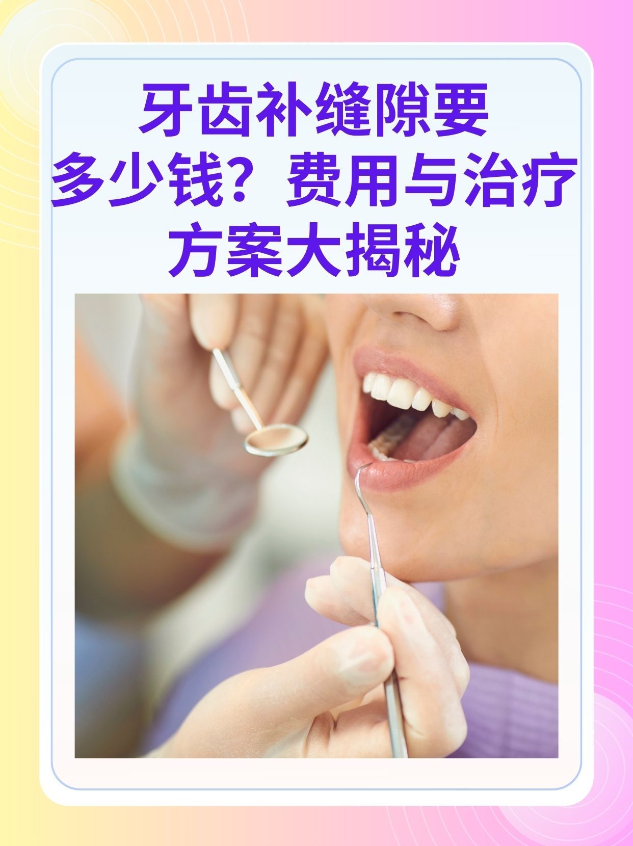 安徽补牙医保可以报销吗(补牙医保可以报销吗 哪些可以报销呢)